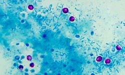 Cryptosporidium parvum